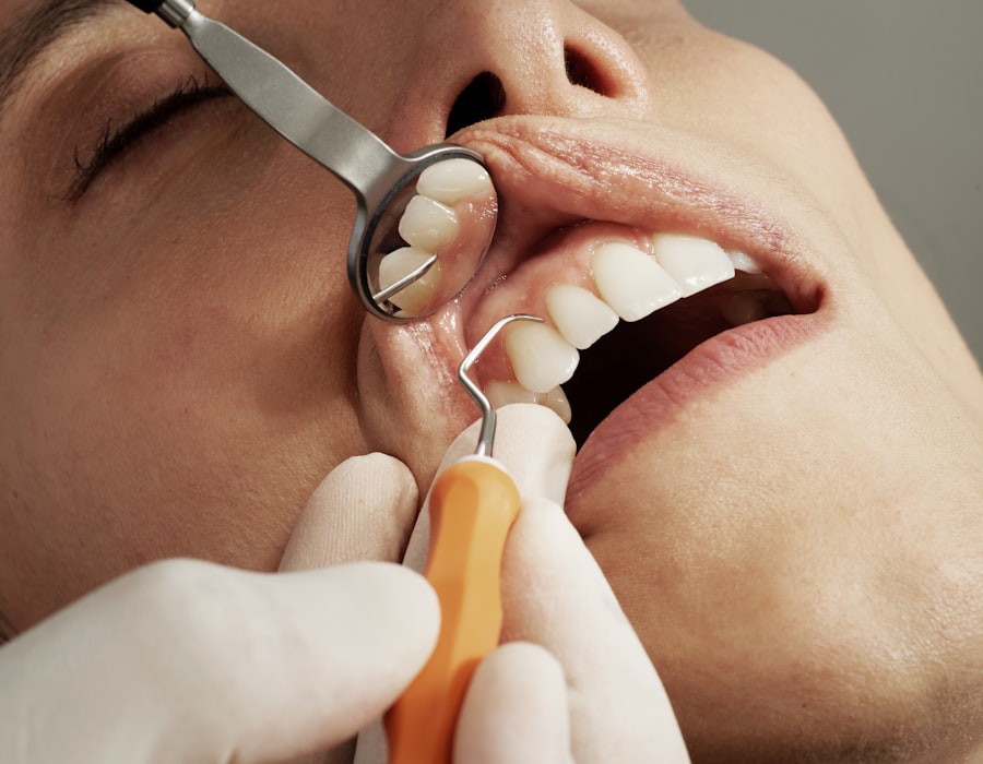 Fillings