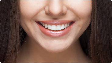 Zoom! Professional Bleaching